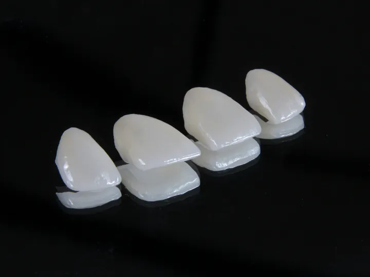 Quatro lâminas finas de porcelana prontas para serem cimentadas